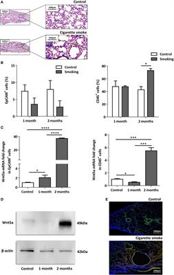 Cigarette Smoke-Induced Pulmonary Inflammation Becomes Systemic by Circulating Extracellular Vesicles Containing Wnt5a and Inflammatory Cytokines